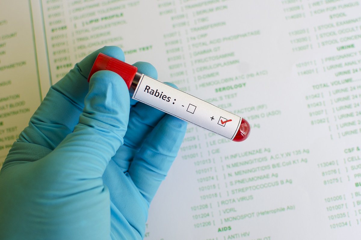 58 cases of rabies registered in Russia in July