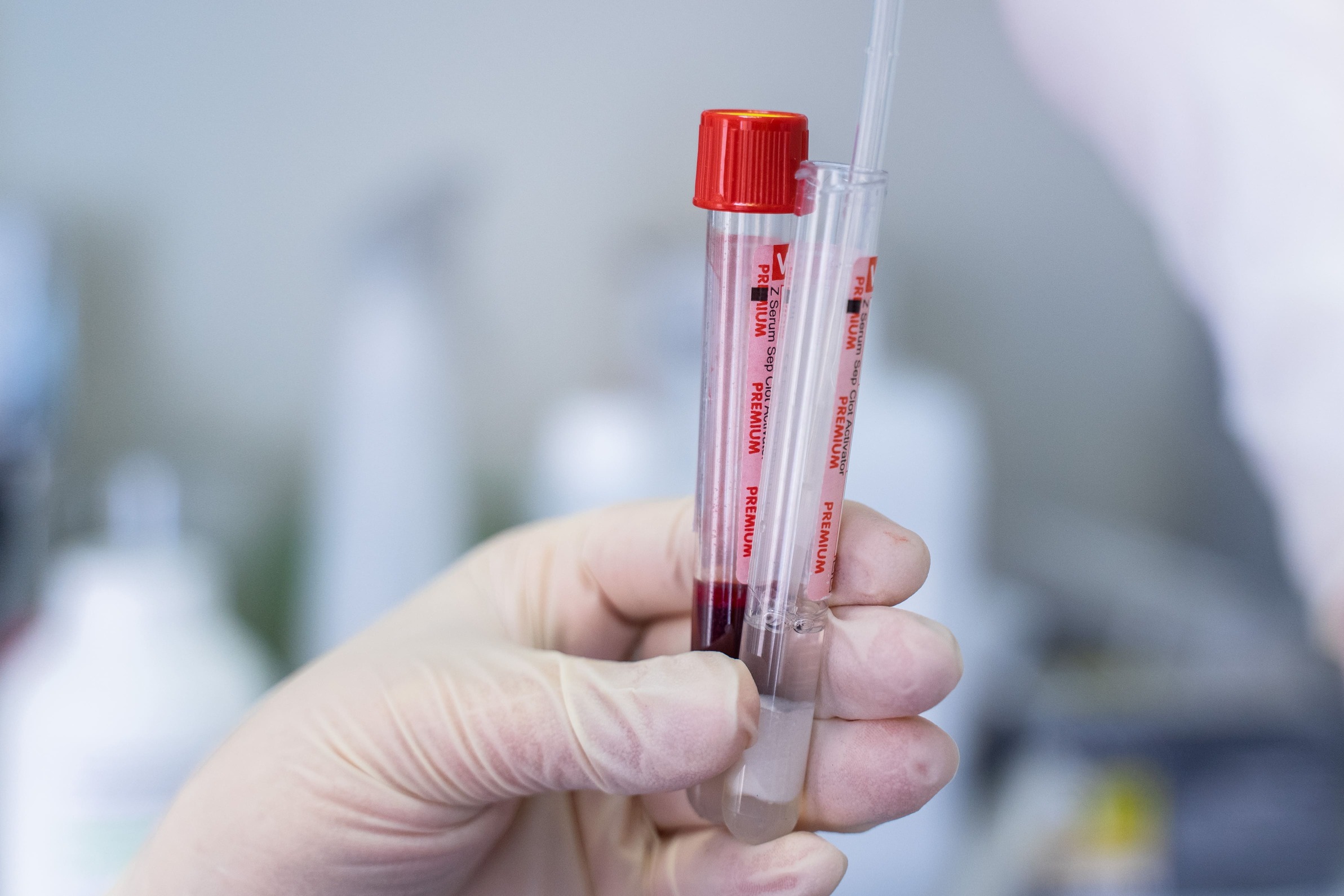 От котов до слонов: ученые нашли универсальный биомаркер старения